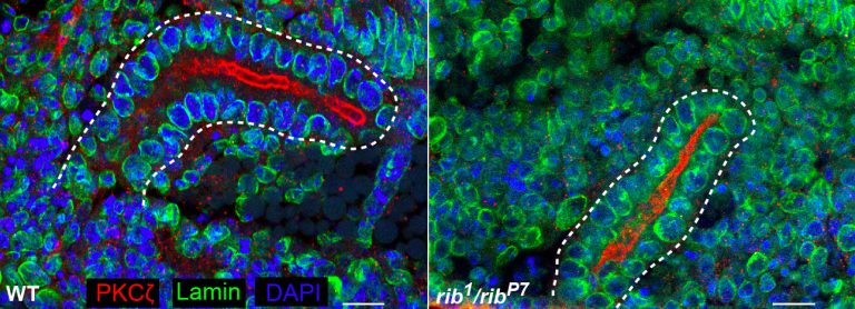 organ morphogenesis